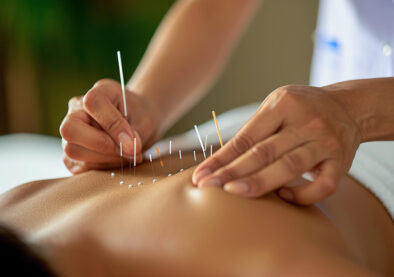 Acupuncture Physiotherapy in Morinville, Acupuncture Services, Chinese Acupuncture & TCM, TCM Acupuncturist, Acupuncture in Morinville 3