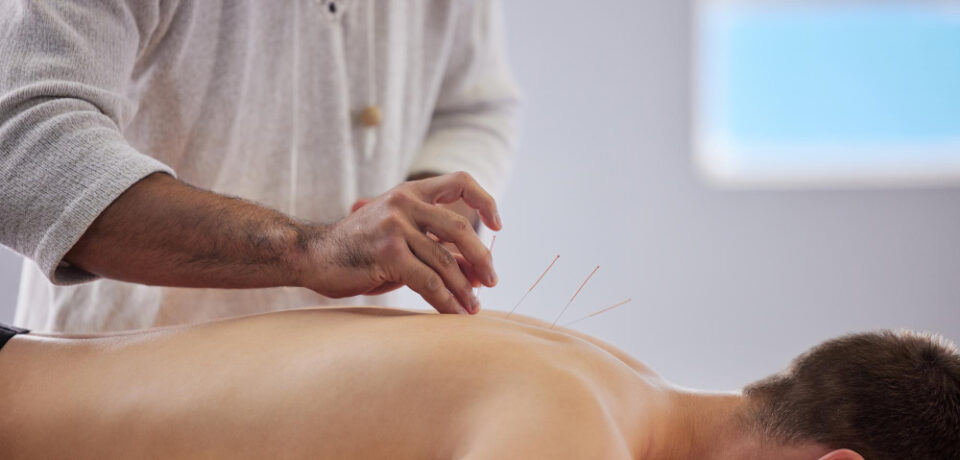 Dry Needling Physiotherapy in Morinville Discover expert Dry Needling Physiotherapy in Morinville at Healrise. Relieve pain, release muscle tension & improve mobility with Functional Dry Needling.