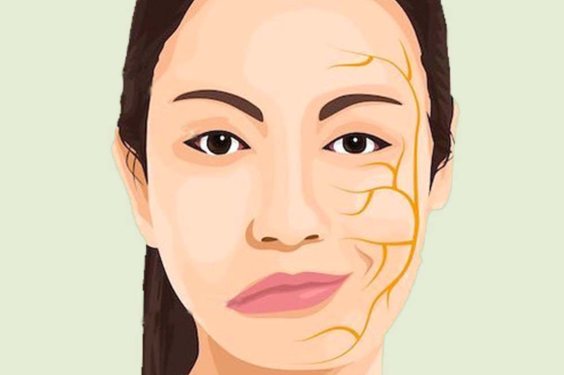 Bell’s Palsy Treatment in Morinville – Regain Confidence & Control