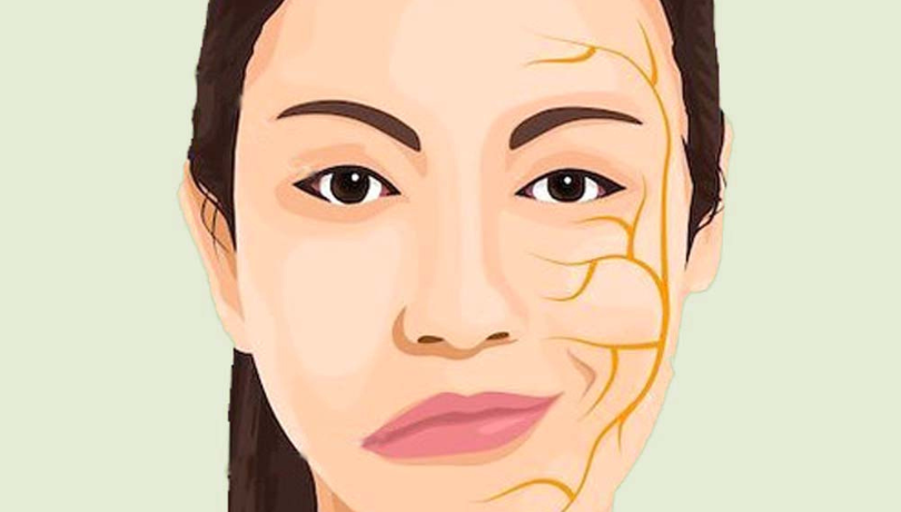 Acupuncture for Bell's Palsy 1 Bell’s Palsy Treatment in Morinville – Regain Confidence & Control