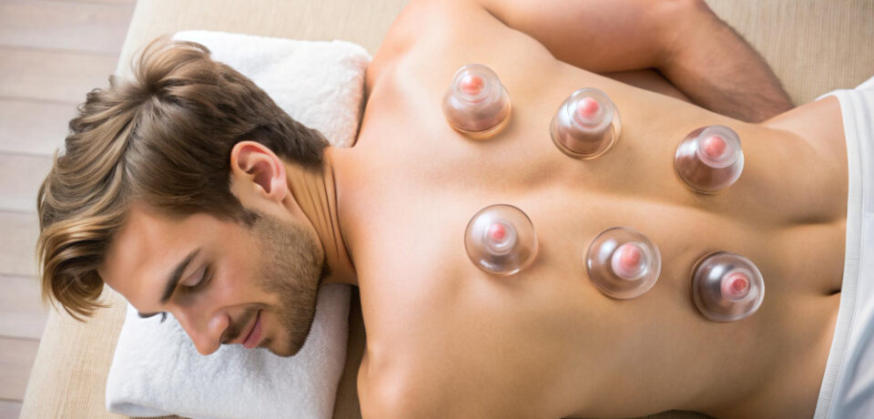 Cupping Therapy