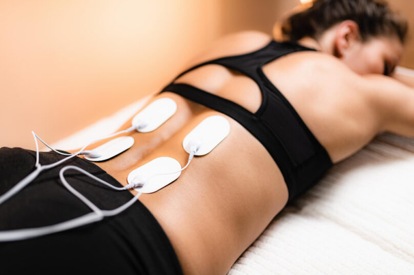 Electrical Stimulation